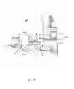 Fig. 10 - Non-invasive breathing assistance apparatus and method