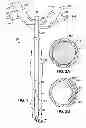 Fig. 02 - Medical tubes for selective mechanical ventilation of the lungs