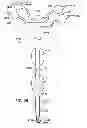 Fig. 10 - Medical tubes for selective mechanical ventilation of the lungs