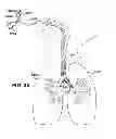 Fig. 14 - Medical tubes for selective mechanical ventilation of the lungs