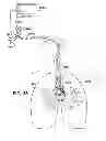 Fig. 16 - Medical tubes for selective mechanical ventilation of the lungs