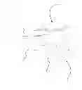 Fig. 01 - Sleep Apnea Dental Appliance and Method of Constructing