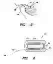 Fig. 04 - EAR INSERT FOR RELIEF OF TMJ DISCOMFORT AND HEADACHES