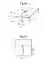 Fig. 04 - Tool for separating a hair bundle