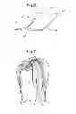 Fig. 06 - Tool for separating a hair bundle