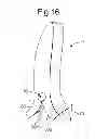 Fig. 13 - Tool for separating a hair bundle