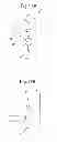 Fig. 14 - Tool for separating a hair bundle