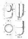 Fig. 04 - Prosthetic liner with continuous distal end area