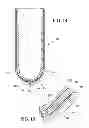 Fig. 06 - Prosthetic liner with continuous distal end area