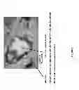 Fig. 06 - Casting mold composition with improved detectability for inclusions and method of casting