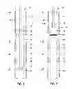 Fig. 02 - Single trip multi-zone drill stem test system