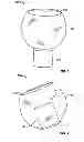 Fig. 03 - Invertible ear tips for an ear piece