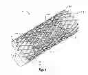 Fig. 02 - Electropolishing method including multi-finger contacts