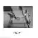Fig. 06 - METHOD AND ELECTROCHEMICAL DEVICE FOR LOW ENVIRONMENTAL IMPACT LITHIUM RECOVERY FROM AQUEOUS SOLUTIONS