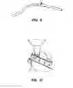 Fig. 06 - Beer Bong