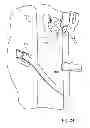 Fig. 15 - Vacuum mounted carrier for a vehicle