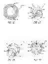 Fig. 13 - Rotating sprinkler head valve