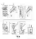 Fig. 15 - Apparatus and process for demanufacturing materials from composite manufactures
