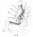 Fig. 10 - Backrest, method for adjusting a backrest and (wheel) chair provided with a backrest