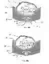 Fig. 12 - Backrest, method for adjusting a backrest and (wheel) chair provided with a backrest