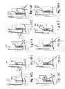 Fig. 25 - Chair back mechanism and control assembly