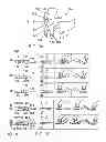 Fig. 04 - Head restraint with an autoreactive framework structure