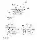 Fig. 10 - Head restraint with an autoreactive framework structure