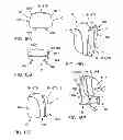 Fig. 16 - Head restraint with an autoreactive framework structure