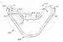 Fig. 01 - Bicycle wheel rim