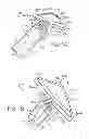 Fig. 02 - SMART MATERIAL ACTUATOR