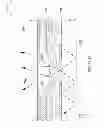 Fig. 06 - DISPLAY APPARATUS WITH MULTI-HEIGHT SPACERS