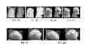 Fig. 06 - ABSOLUTE THREE-DIMENSIONAL SHAPE MEASUREMENT USING CODED FRINGE PATTERNS WITHOUT PHASE UNWRAPPING OR PROJECTOR CALIBRATION