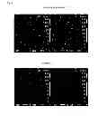 Fig. 07 - Laminated ceramic electronic component and manufacturing method therefor