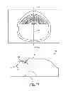 Fig. 77 - Light directing apparatus