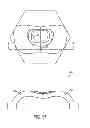 Fig. 97 - Light directing apparatus
