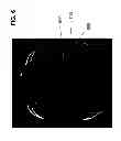 Fig. 09 - Patient head support apparatus for imaging