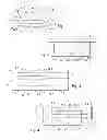 Fig. 02 - Hearing instrument