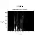 Fig. 08 - Hearing assistance apparatus