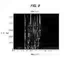 Fig. 09 - Hearing assistance apparatus