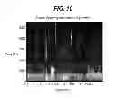 Fig. 10 - Hearing assistance apparatus