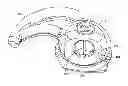 Fig. 01 - Earpiece positioning and retaining