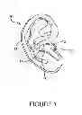 Fig. 02 - Earphones