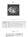 Fig. 08 - Medical image compression device, medical image compression method, and prediction knowledge database creation device