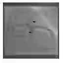 Fig. 01 - Method and system for real time stent enhancement on live 2D fluoroscopic scene
