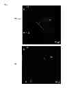 Fig. 06 - Method and system for real time stent enhancement on live 2D fluoroscopic scene