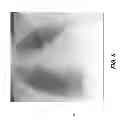 Fig. 06 - Rib suppression in radiographic images