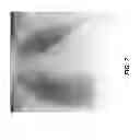 Fig. 09 - Rib suppression in radiographic images