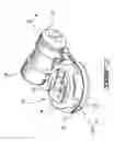 Fig. 02 - OVERMOULDING METHOD AND OVERMOULDED ELECTRONIC DEVICE