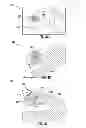 Fig. 06 - Floating fasteners