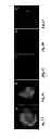 Fig. 06 - NANOPARTICLES BASED FOR DERMAL AND SYSTEMIC DELIVERY OF DRUGS